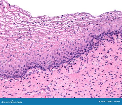 Vaginal Histology Stratified Squamous Epithelium And | The Best Porn ...