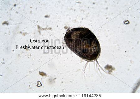 Microscopic Freshwater Image & Photo (Free Trial) | Bigstock