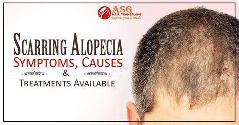 Scarring Alopecia