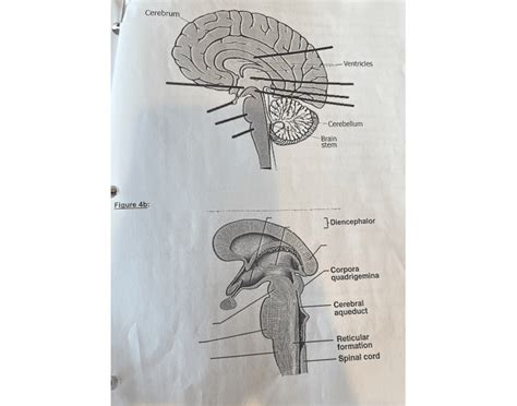 Anatomy - Brain Quiz