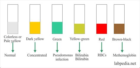 Urine Analysis: Part 4 – Urine Physical Examination, and Interpretation ...