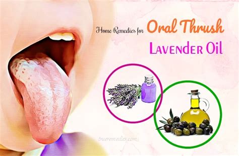 13 Home Remedies For Oral Thrush In Babies And Adults