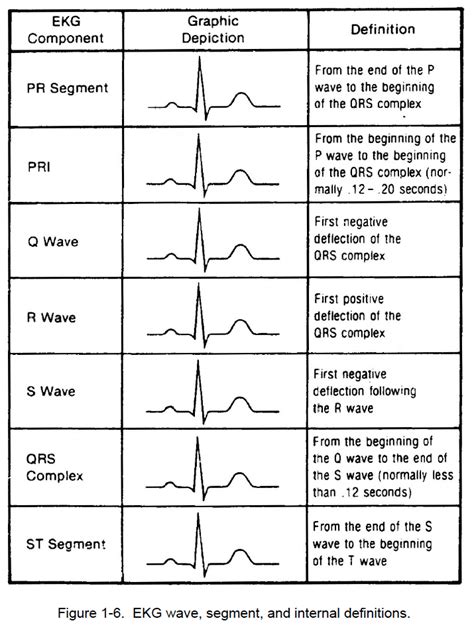 Figure 1-6. EKG wave, segment, and internal definitions - Cardiac ...