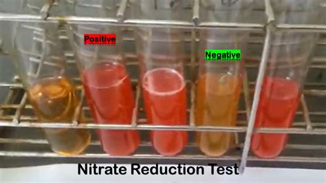 Principle of Nitrate/Nitrite Reduction Test Archives - Medical Notes