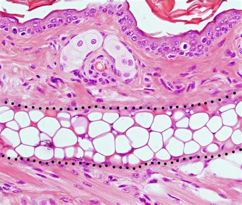 Elastic Cartilage Histology