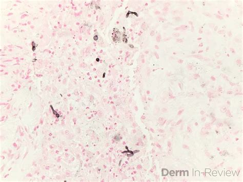 Figure 5.8.17 – Derm In-Review