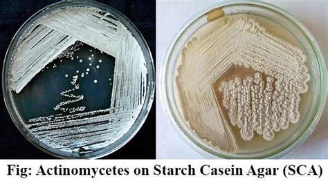 Starch Casein Agar (SCA) - Composition, Principle, Uses, Preparation ...