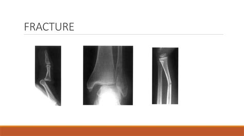 ORTHOPEDIC XRAYS.pptx