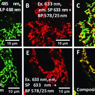 A) Normalized auto-fluorescence, MitoTracker-Green fluorescence and ...