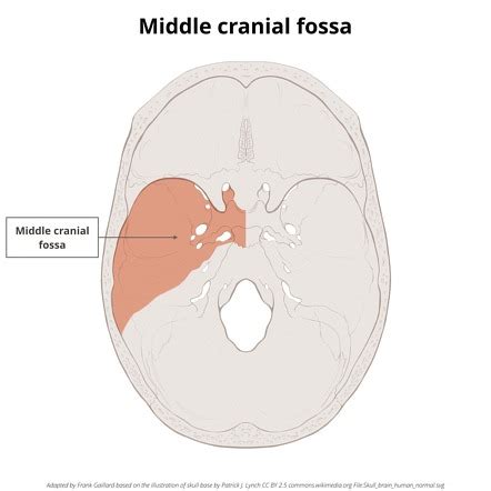 Middle Cranial Fossa