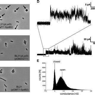 SpdB2-His promotes spheroplast formation by T7 lysozyme and forms ...