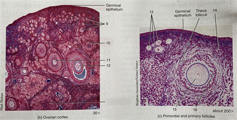 Quiz 4: Histology of ovary (ovarian cortex & primordial and primary ...