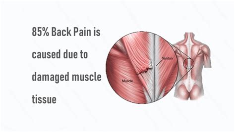 Upper Back Muscles Anatomy