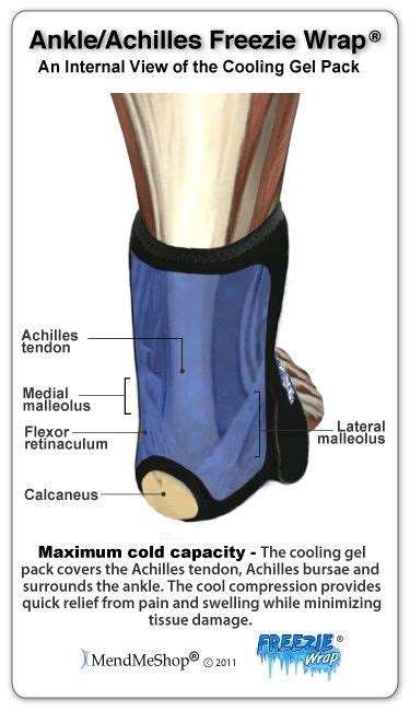 Visit Achilles Tendon Bursitis Physical Therapy - Sandy Springs,GA ...