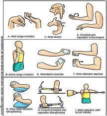 Lateral Epicondylitis - Physiopedia