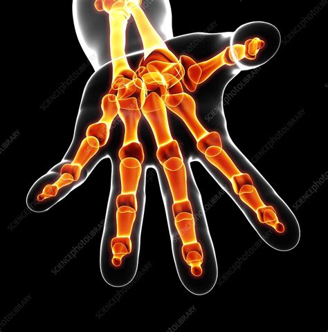 Human hand bones, artwork - Stock Image - F007/3552 - Science Photo Library