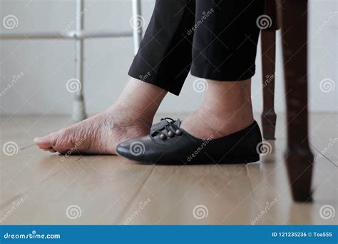 Elderly Woman Swollen Feet Putting on Shoes Stock Photo - Image of home ...