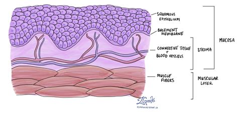 Squamous epithelium | MyPathologyReport.ca