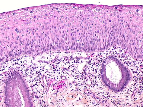 Endocervix Histology