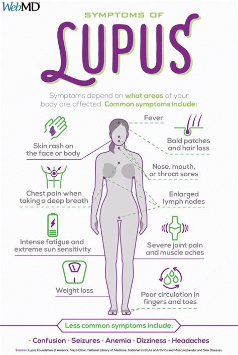 Slideshow: A Visual Guide to Lupus - WebMD - #Guide #Lupus #Slideshow # ...