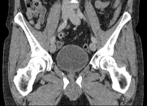 11 Types Of CT Scans - Deep Medical Centre