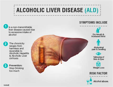 what causes liver damage - DriverLayer Search Engine