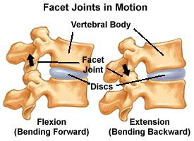 Understanding Spinal Anatomy: Facet Joints