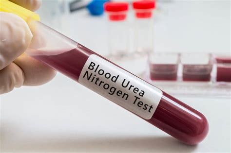 Determination of Urea in the Blood - Dr. Sunil Prakash