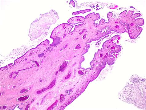 Endocervix Histology