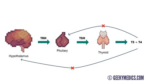 Thyroid Function Test Interpretation (TFT Interpretation) | Geeky Medics