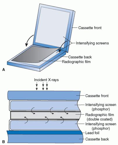 X-ray Imaging: Radiography and Fluoroscopy | Radiology Key