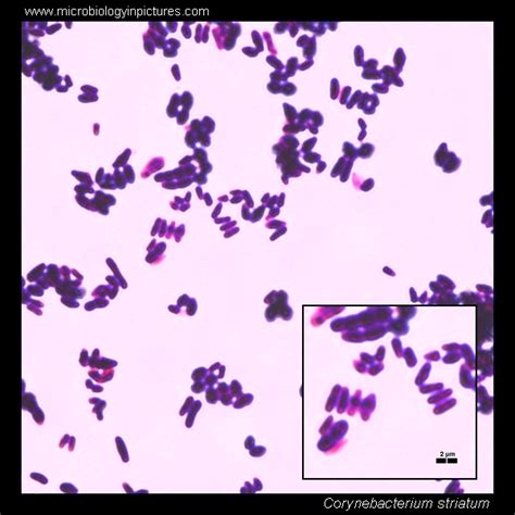 Corynebacterium striatum microscopy. Diphtheroids micrograph ...