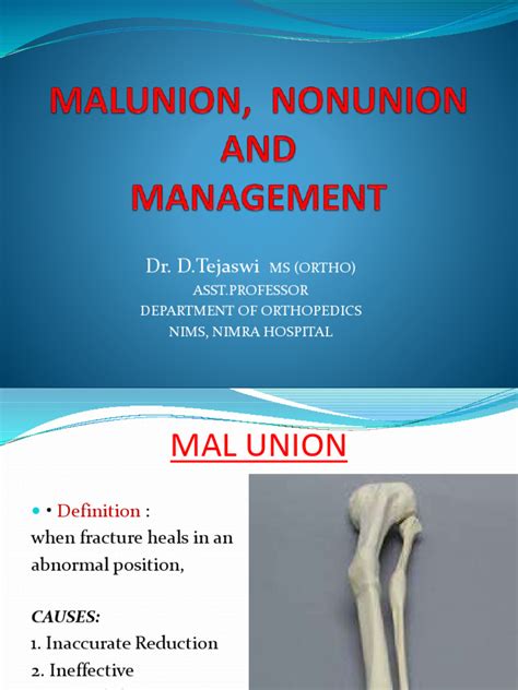 S-Malunion and Nonunion | PDF | Surgical Specialties | Clinical Medicine