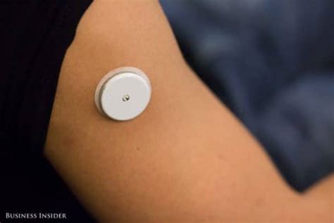 This Wearable Monitors Your Blood Glucose Levels In Real-Tim