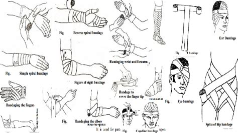 Uses, Guidelines and Types of bandages.