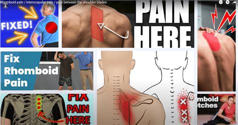 Rhomboid Pain / Interscapular Pain | What is it and how to "fix" it!