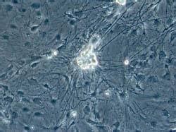 Mouse Skin Into Neurons Without Need for Pluripotent Stem Cells