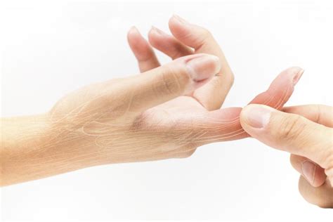 Fabulous Tips About How To Heal Swollen Finger - Strangertourist2