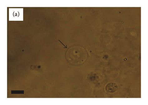 The morphology of the spheroplast W303 cells inside four different ...