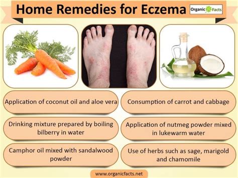 Eczema Home Remedies Reddit: Tips, Tricks, And Reviews – MartLabPro