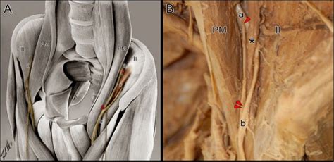 Femoral Nerve And Psoas Muscle