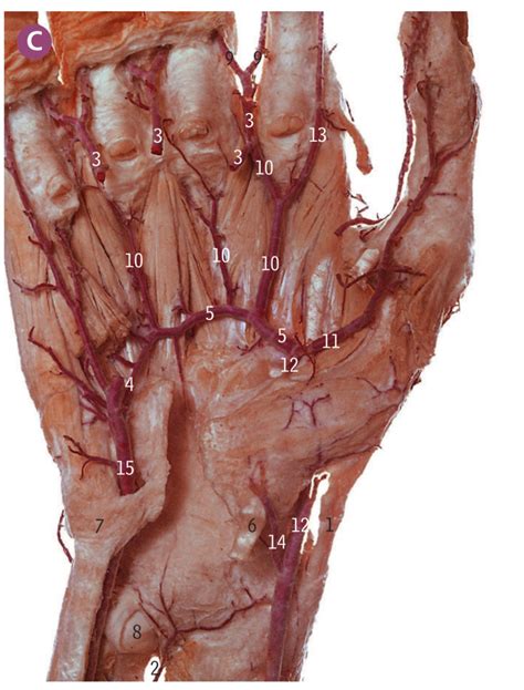 Upper limb - Right hand: deep palmar arteries Diagram | Quizlet