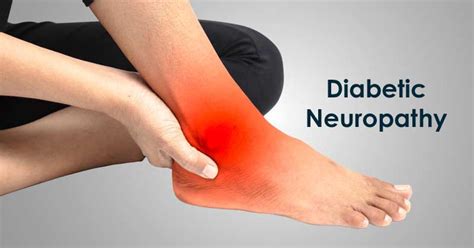 Diabetic Neuropathy- Know Its Symptoms and Causes