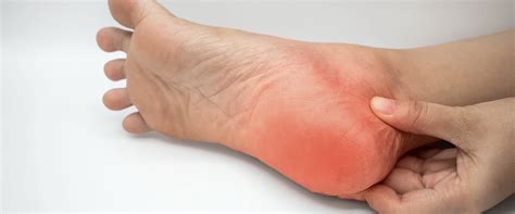 Diabetic Neuropathy Treatment | Insulinic of Florida