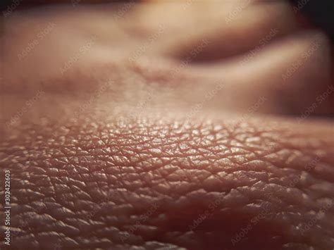 macro skin of human hand.Medicine and dermatology concept. Details of ...