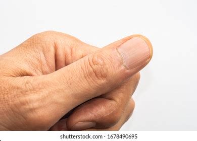 94 Vertical lines fingernails Images, Stock Photos & Vectors | Shutterstock