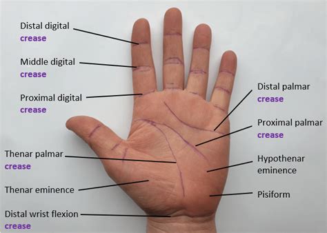 Palmar Hand Anatomy Diagram