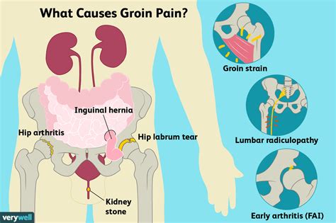 Groin Pain: Causes, Treatment, and When to See a Doctor