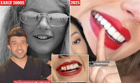 As Taylor Swift appears to FINALLY fix chipped tooth after a decade ...