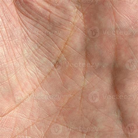 Close up of human hand skin with visible skin texture and lines ...